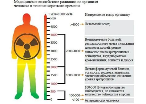 Нормы радиации