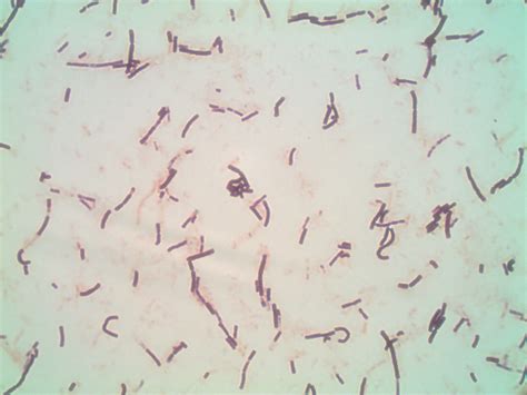 Lactobacillus species